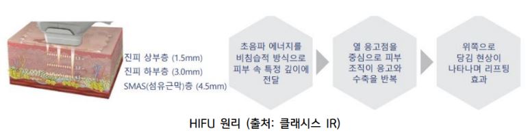 'hifu'의 원리에 대해 설명해주는 '클래시스'의 이미지 자료.